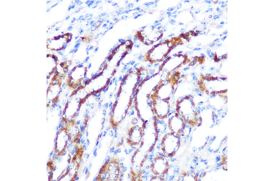 Immunohistochemistry - Anti-SGK1 Antibody (A12861) - Antibodies.com