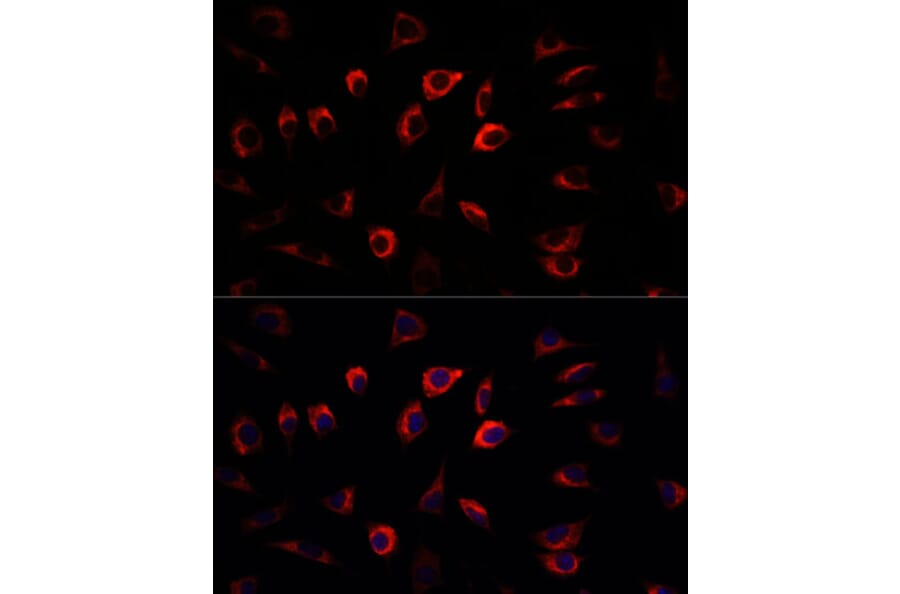 Immunofluorescence - Anti-SGK1 Antibody (A12861) - Antibodies.com