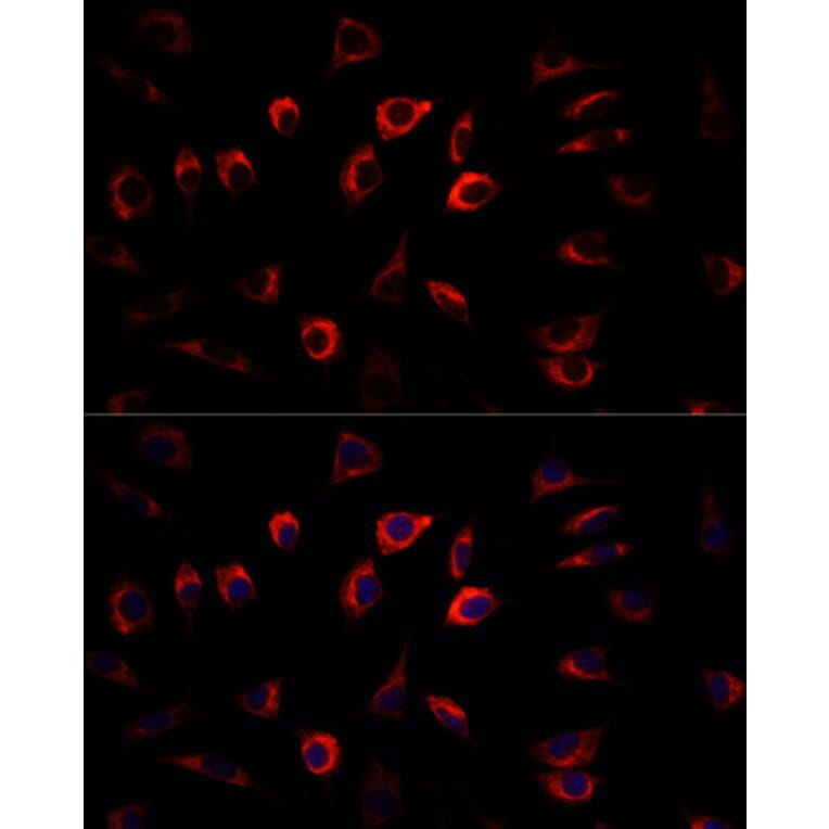 Immunofluorescence - Anti-SGK1 Antibody (A12861) - Antibodies.com
