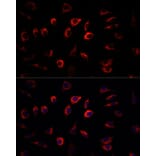 Immunofluorescence - Anti-SGK1 Antibody (A12861) - Antibodies.com