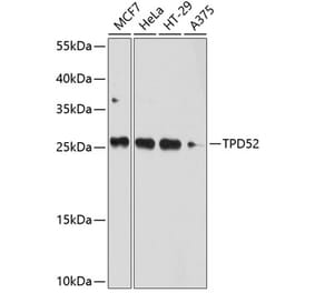 Western Blot - Anti-TPD52 Antibody (A12862) - Antibodies.com