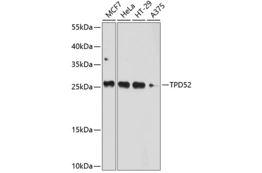 Western Blot - Anti-TPD52 Antibody (A12862) - Antibodies.com