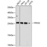 Western Blot - Anti-TPD52 Antibody (A12862) - Antibodies.com