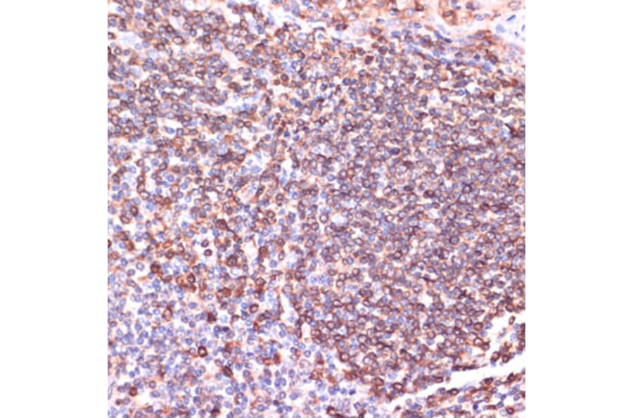 Immunohistochemistry - Anti-TPD52 Antibody (A12862) - Antibodies.com