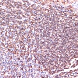 Immunohistochemistry - Anti-TPD52 Antibody (A12862) - Antibodies.com