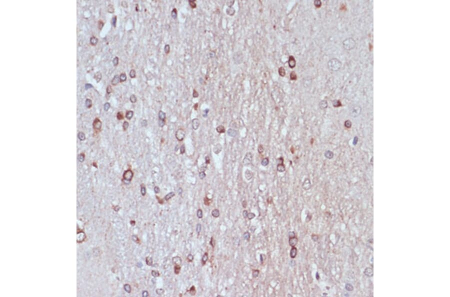 Immunohistochemistry - Anti-TPD52 Antibody (A12862) - Antibodies.com