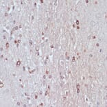 Immunohistochemistry - Anti-TPD52 Antibody (A12862) - Antibodies.com
