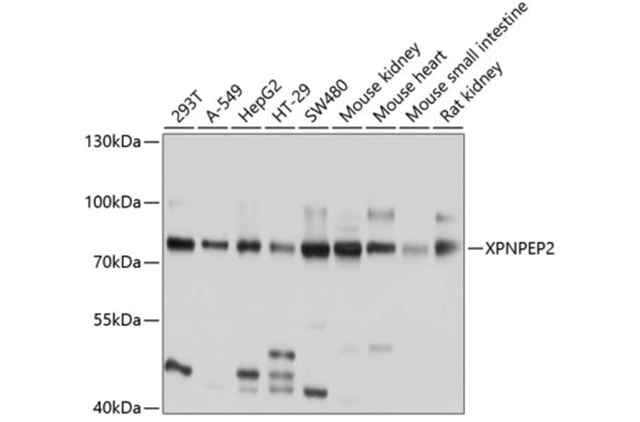 Western Blot - Anti-XPNPEP2/mAPP Antibody (A12863) - Antibodies.com
