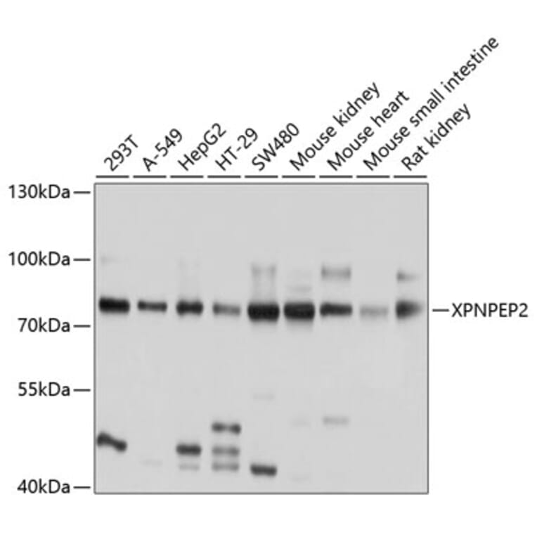 Western Blot - Anti-XPNPEP2/mAPP Antibody (A12863) - Antibodies.com