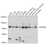 Western Blot - Anti-XPNPEP2/mAPP Antibody (A12863) - Antibodies.com