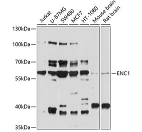Western Blot - Anti-ENC1 Antibody (A12864) - Antibodies.com