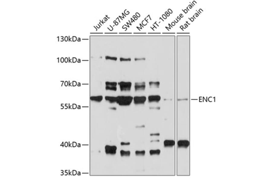 Western Blot - Anti-ENC1 Antibody (A12864) - Antibodies.com