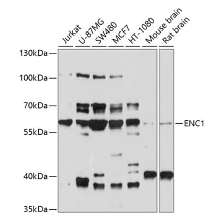 Western Blot - Anti-ENC1 Antibody (A12864) - Antibodies.com
