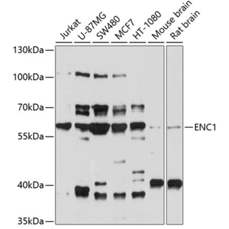 Western Blot - Anti-ENC1 Antibody (A12864) - Antibodies.com