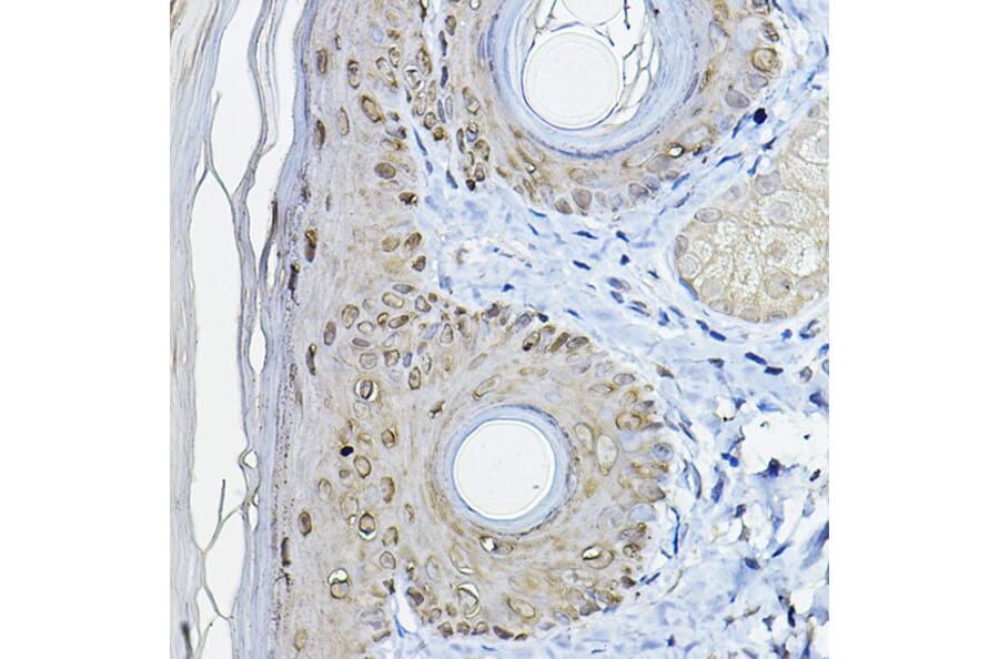 Immunohistochemistry - Anti-14-3-3 sigma/SFN Antibody (A12866) - Antibodies.com