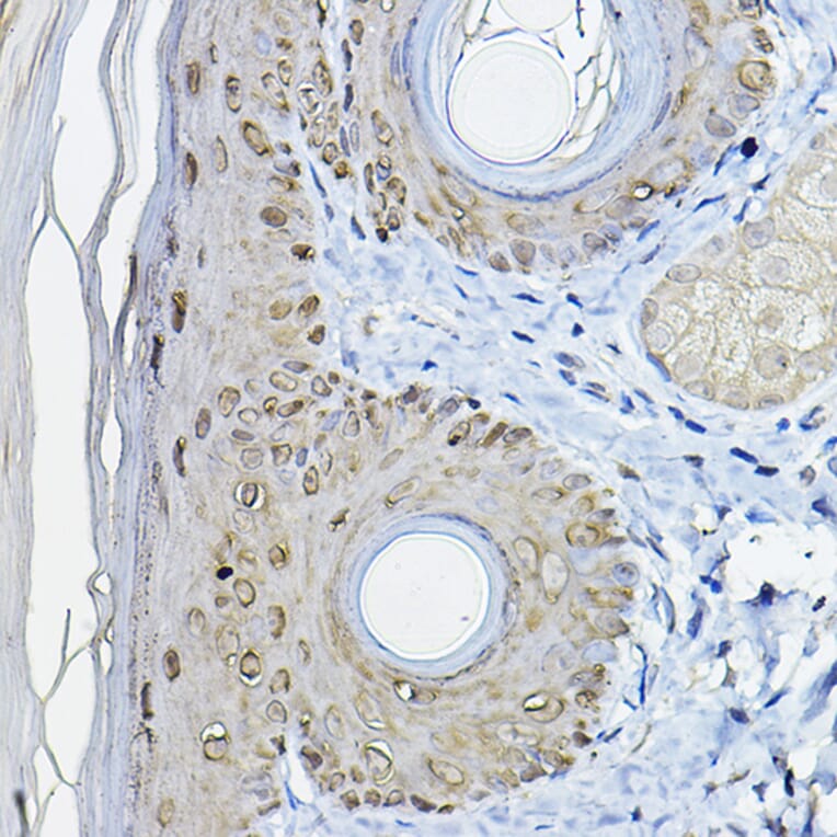 Immunohistochemistry - Anti-14-3-3 sigma/SFN Antibody (A12866) - Antibodies.com