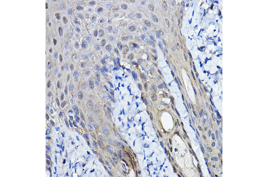Immunohistochemistry - Anti-14-3-3 sigma/SFN Antibody (A12866) - Antibodies.com
