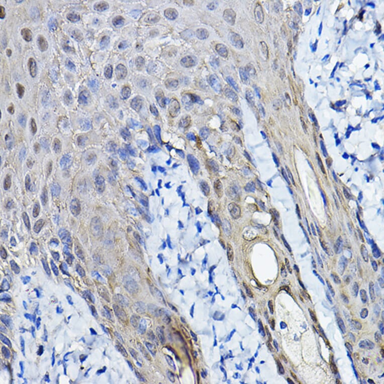 Immunohistochemistry - Anti-14-3-3 sigma/SFN Antibody (A12866) - Antibodies.com