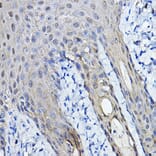 Immunohistochemistry - Anti-14-3-3 sigma/SFN Antibody (A12866) - Antibodies.com