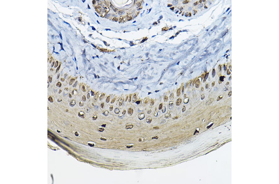 Immunohistochemistry - Anti-14-3-3 sigma/SFN Antibody (A12866) - Antibodies.com