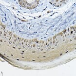 Immunohistochemistry - Anti-14-3-3 sigma/SFN Antibody (A12866) - Antibodies.com