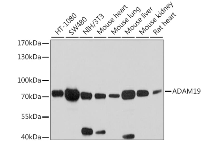 Western Blot - Anti-ADAM19 Antibody (A12867) - Antibodies.com