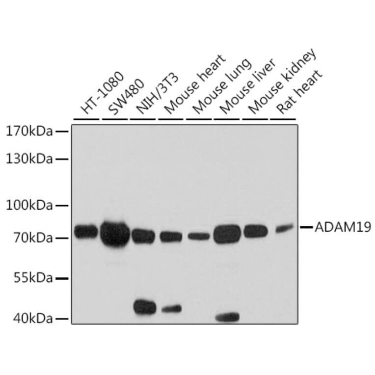 Western Blot - Anti-ADAM19 Antibody (A12867) - Antibodies.com