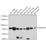 Western Blot - Anti-ADAM19 Antibody (A12867) - Antibodies.com