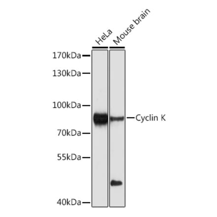 Western Blot - Anti-Cyclin K Antibody (A12868) - Antibodies.com