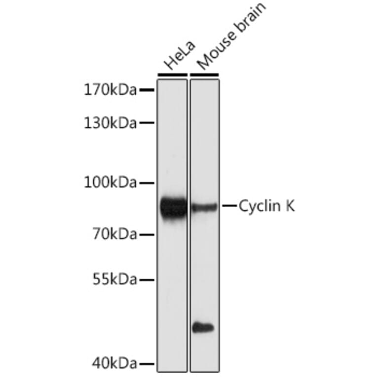 Western Blot - Anti-Cyclin K Antibody (A12868) - Antibodies.com