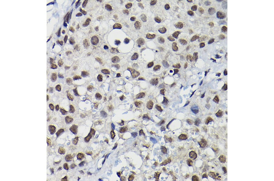 Immunohistochemistry - Anti-Cyclin K Antibody (A12868) - Antibodies.com