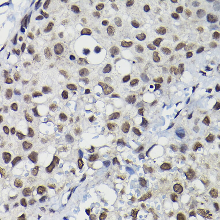 Immunohistochemistry - Anti-Cyclin K Antibody (A12868) - Antibodies.com