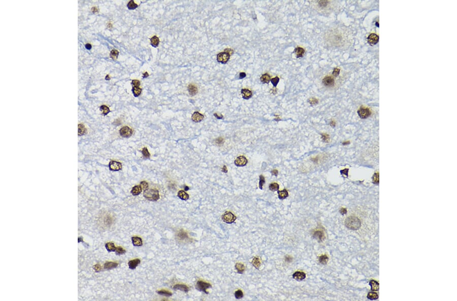 Immunohistochemistry - Anti-Cyclin K Antibody (A12868) - Antibodies.com