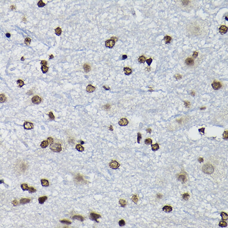 Immunohistochemistry - Anti-Cyclin K Antibody (A12868) - Antibodies.com