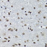Immunohistochemistry - Anti-Cyclin K Antibody (A12868) - Antibodies.com