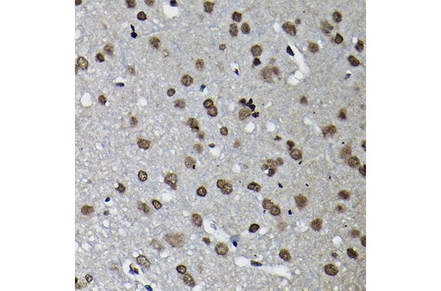 Immunohistochemistry - Anti-Cyclin K Antibody (A12868) - Antibodies.com