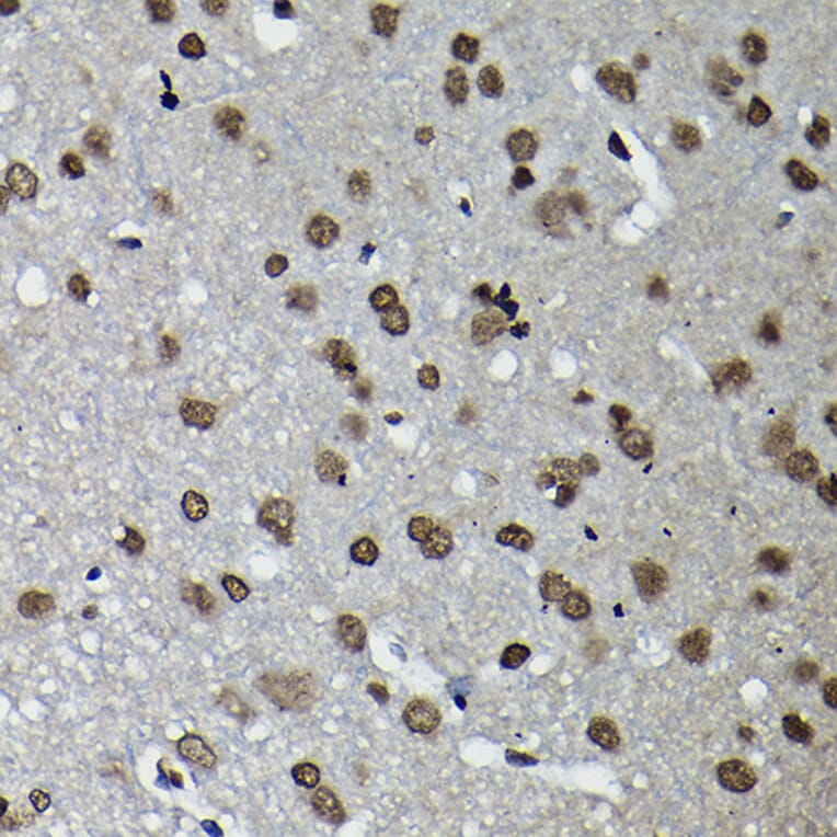 Immunohistochemistry - Anti-Cyclin K Antibody (A12868) - Antibodies.com
