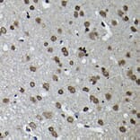 Immunohistochemistry - Anti-Cyclin K Antibody (A12868) - Antibodies.com