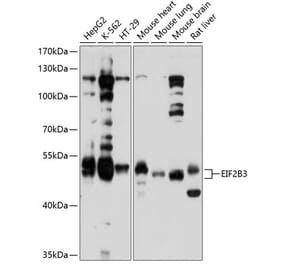 Western Blot - Anti-eIF2B3 Antibody (A12869) - Antibodies.com