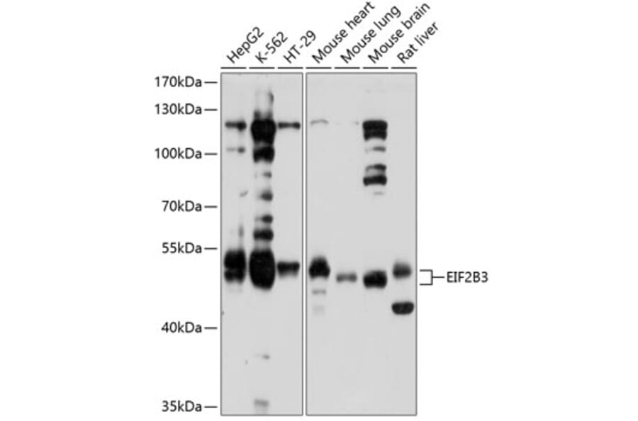 Western Blot - Anti-eIF2B3 Antibody (A12869) - Antibodies.com