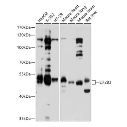 Western Blot - Anti-eIF2B3 Antibody (A12869) - Antibodies.com