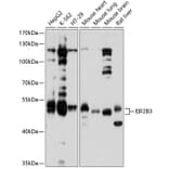 Western Blot - Anti-eIF2B3 Antibody (A12869) - Antibodies.com