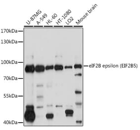 Western Blot - Anti-EIF2B5 Antibody (A12870) - Antibodies.com