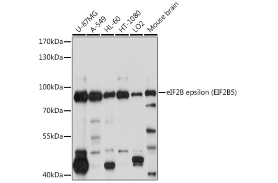 Western Blot - Anti-EIF2B5 Antibody (A12870) - Antibodies.com