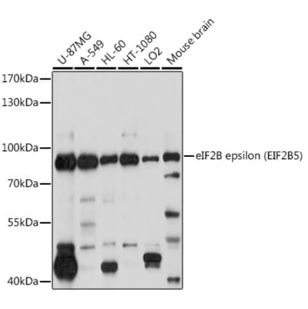 Western Blot - Anti-EIF2B5 Antibody (A12870) - Antibodies.com