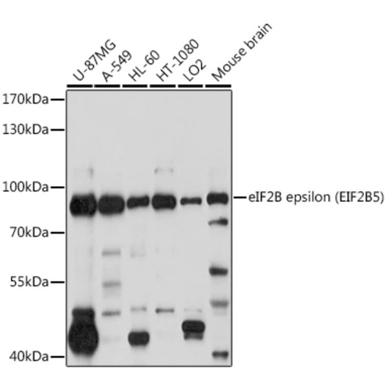 Western Blot - Anti-EIF2B5 Antibody (A12870) - Antibodies.com