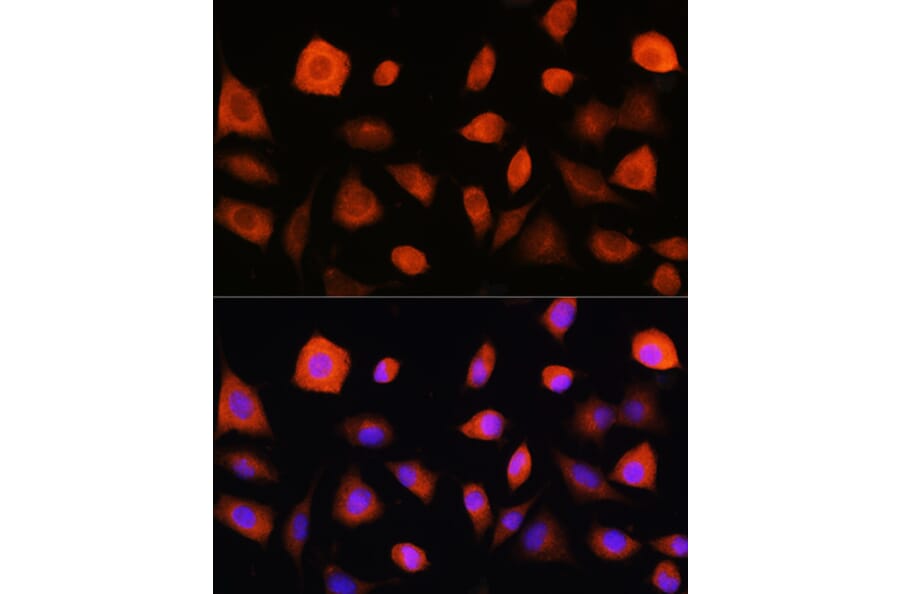 Immunofluorescence - Anti-EIF2B5 Antibody (A12870) - Antibodies.com
