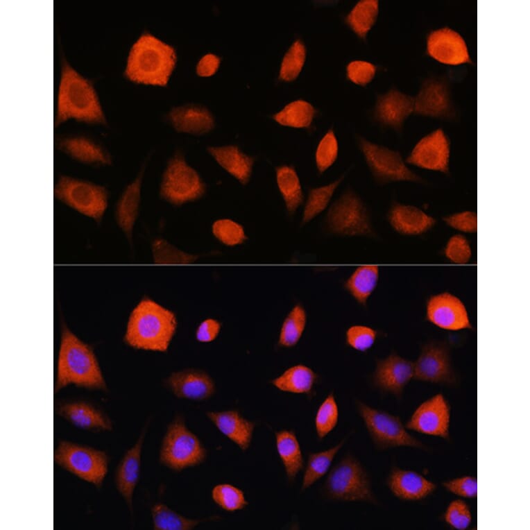 Immunofluorescence - Anti-EIF2B5 Antibody (A12870) - Antibodies.com
