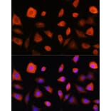 Immunofluorescence - Anti-EIF2B5 Antibody (A12870) - Antibodies.com