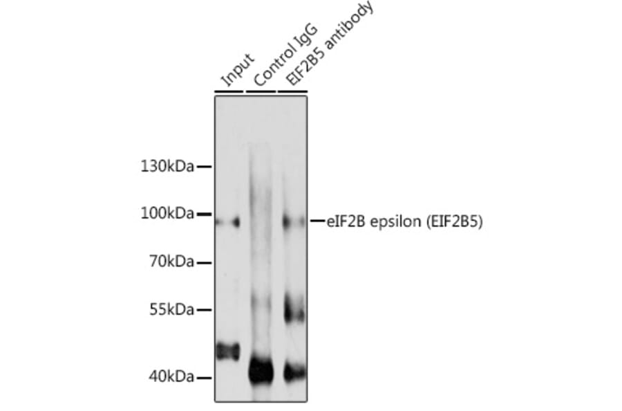 Western Blot - Anti-EIF2B5 Antibody (A12870) - Antibodies.com